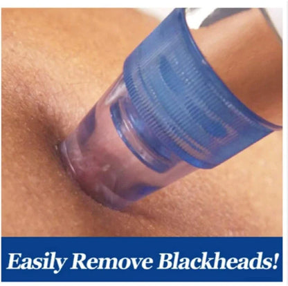 Blackhead Remover Vacuum – Rechargeable Pore Cleaner for All Skin Types